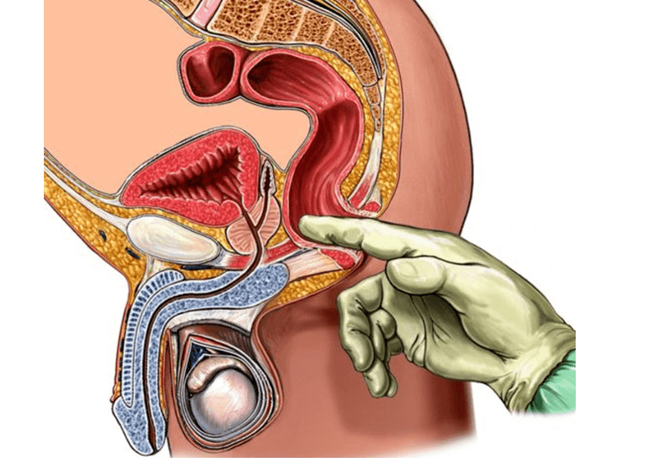 Masaje de prostata y punto g para hombres. 